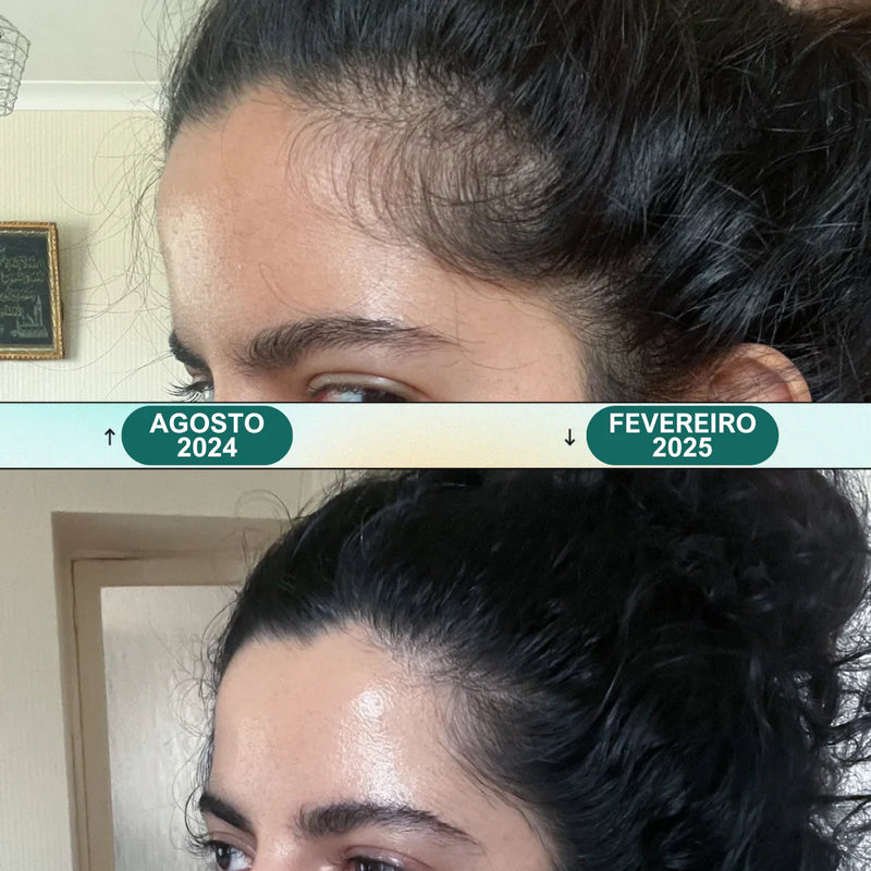 Massageador Relaxante Elétrico para Couro Cabeludo - Renovati Hair